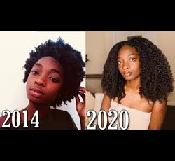 Hair Growth for Women